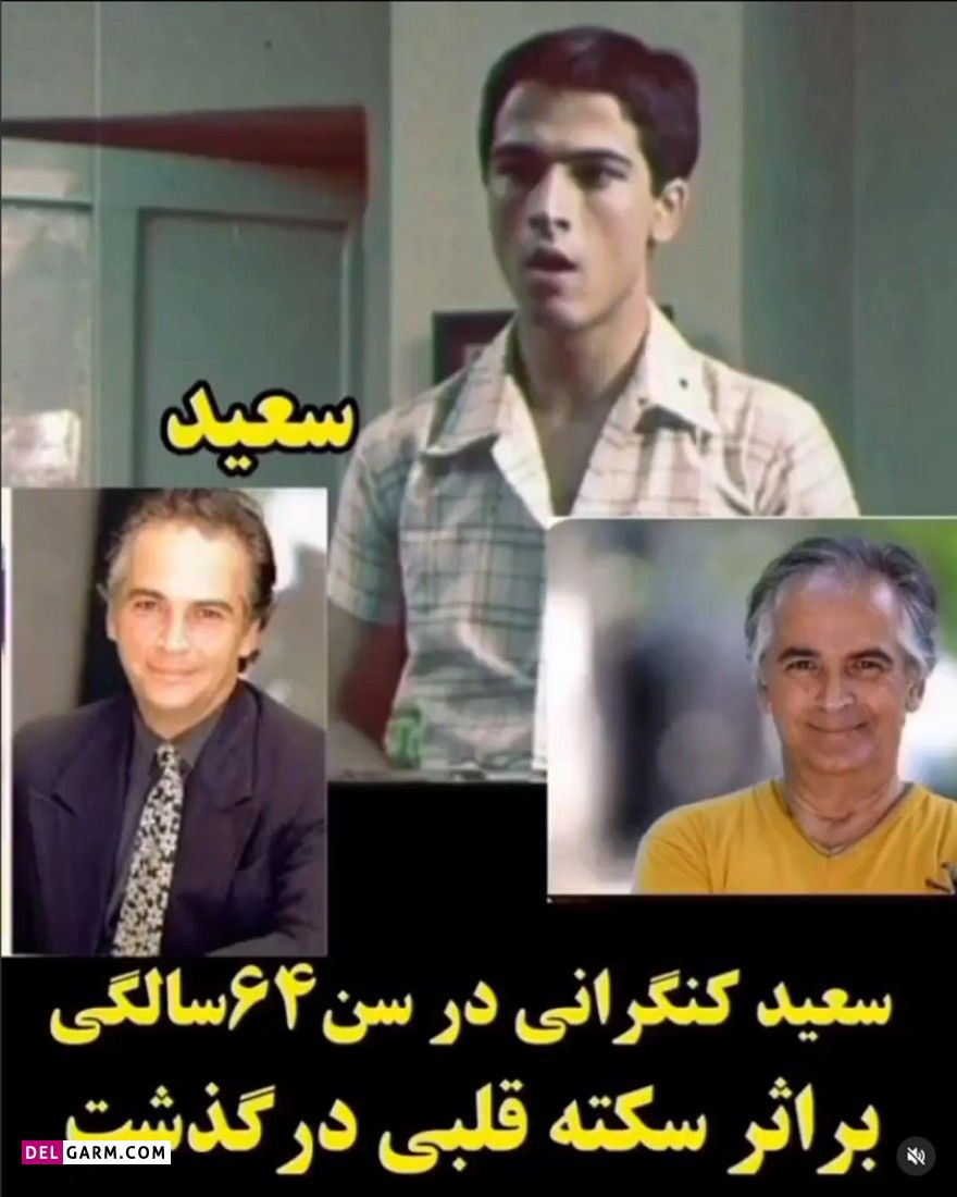 تغییر چهره بازیگران دایی جان ناپلئون