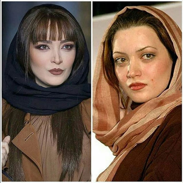 تصاویر دیدنی از قبل و بعد بازیگران ایرانی