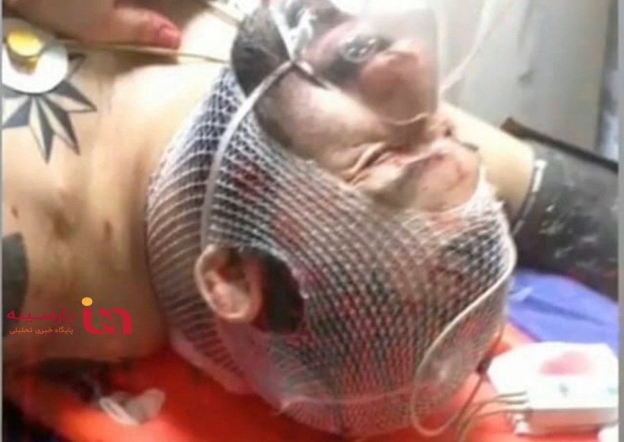 کشته شدن هانی کرده صحت دارد ؟