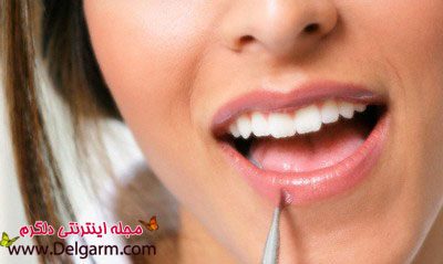 ترک خوردگی لب ها