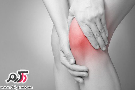 با این علائم بدانید که زانوهایتان بیمار است!!
