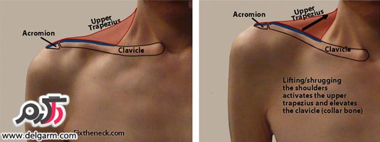 علت افتادگی شانه ها و درمان این عارضه