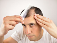چه داروهایی باعث ریزش مو می شود؟