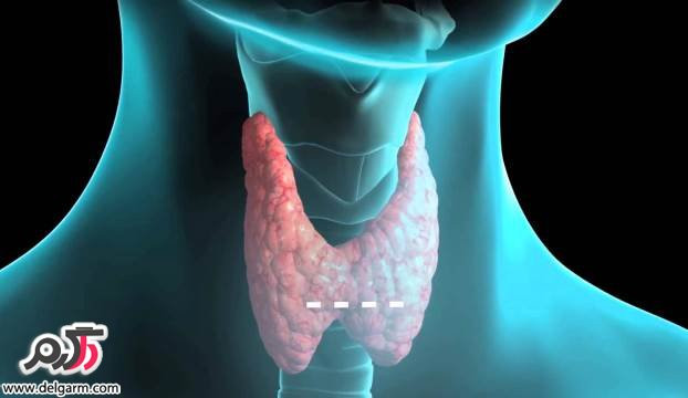 همه چیز در مورد بیماری تیروئیدیت هاشیماتو