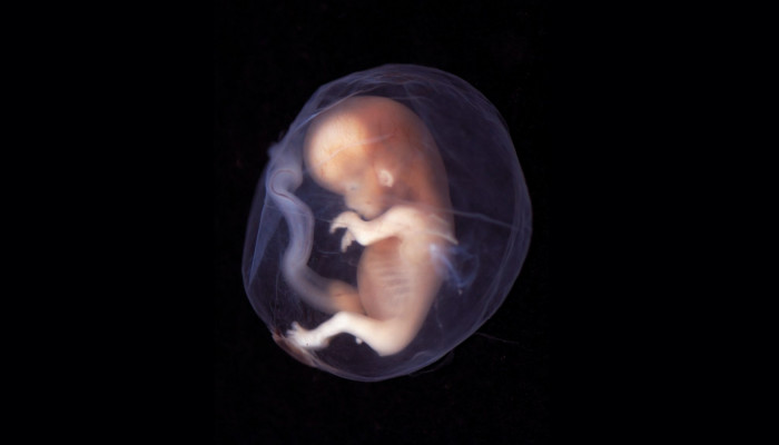 آیا رژلب باعث سقط جنین می شود ؟