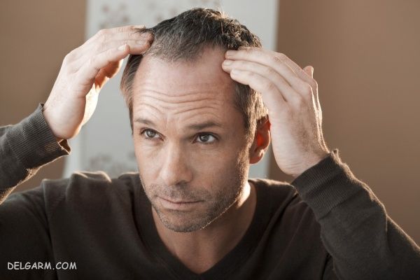 خرگوشک برای درمان ریزش مو و رشد موها