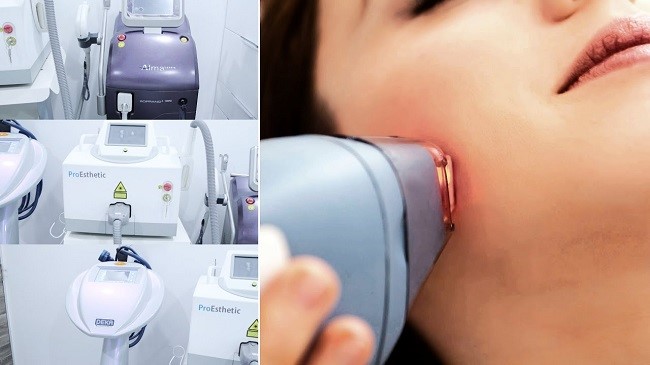 لیزر چگونه موهای زائد را از بین میبرد؟