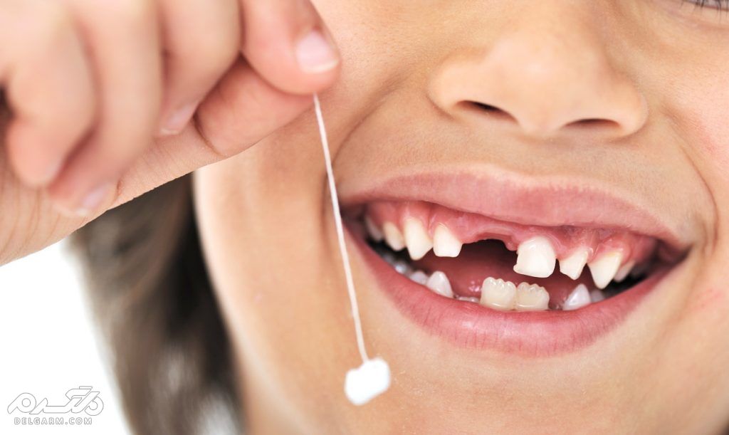 شیری ها و عصب کشی: آیا دندان شیری عصب دارد