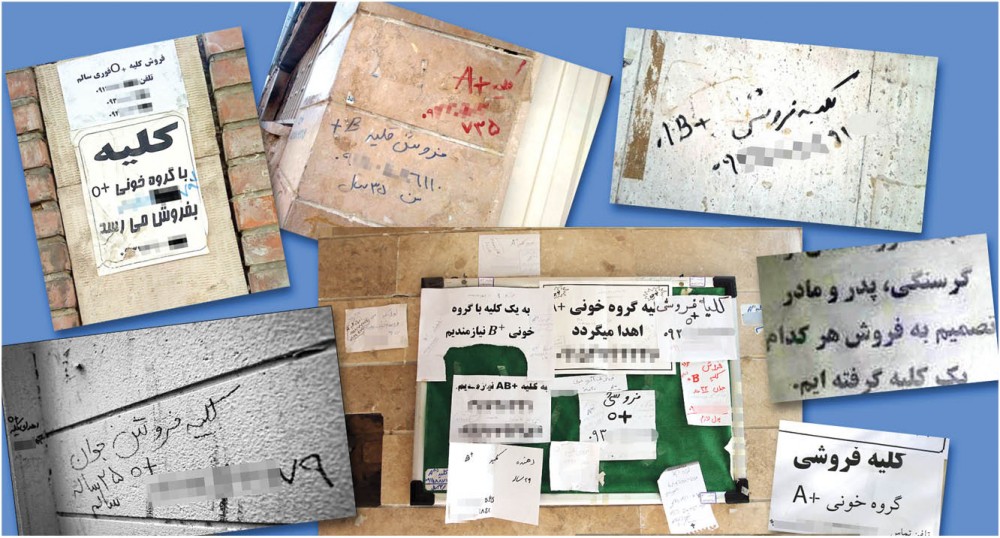 خرید و فروش اعضای بدن چه حکمی دارد؟