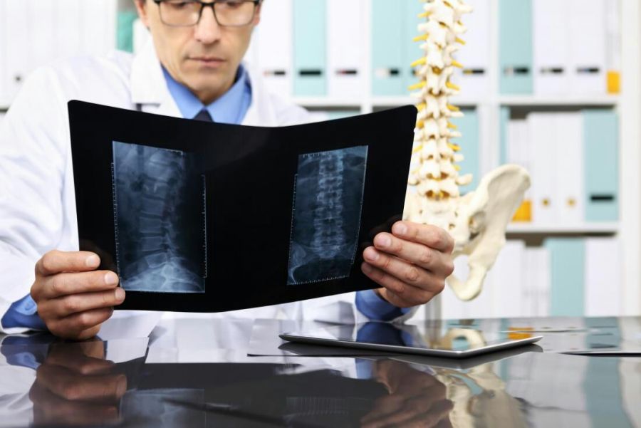 سرطان سارکوم را بشناسید! علائم،علل و درمان سارکوم