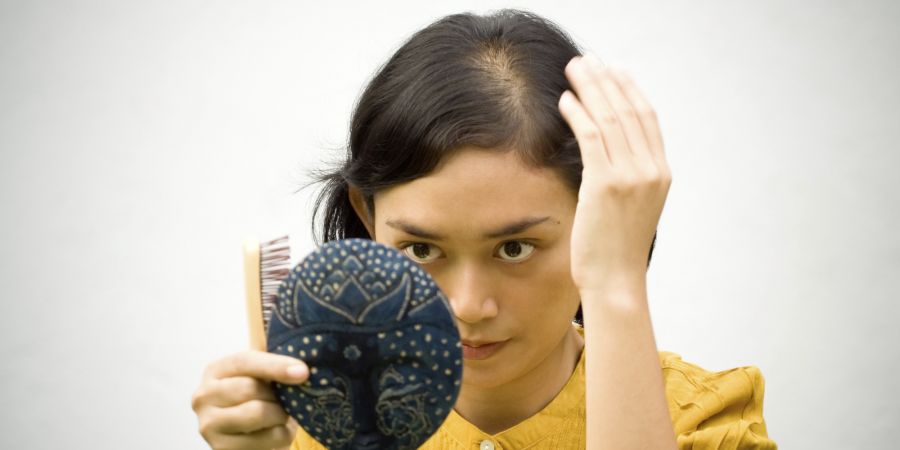 علت ریزش موی آندروژنیک + درمان