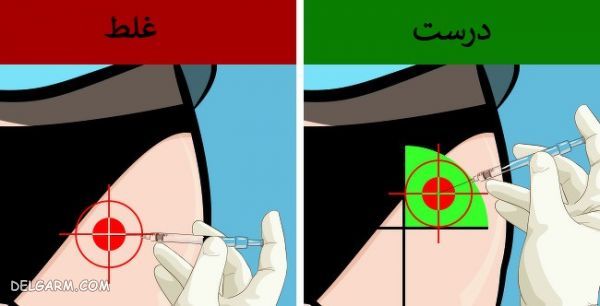 آموزش تصویری آمپول زدن به پشت