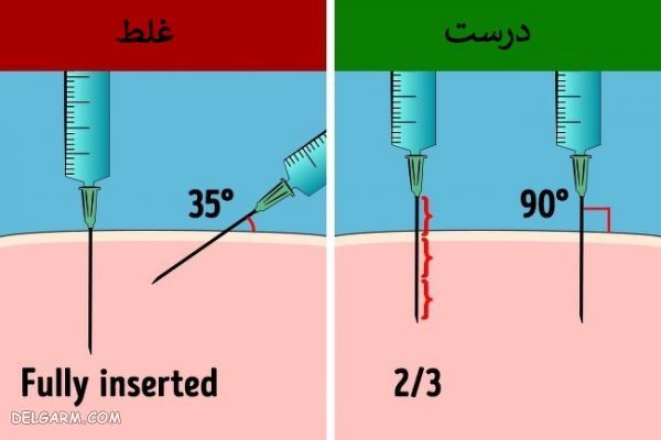 آموزش تصویری آمپول زدن به پشت