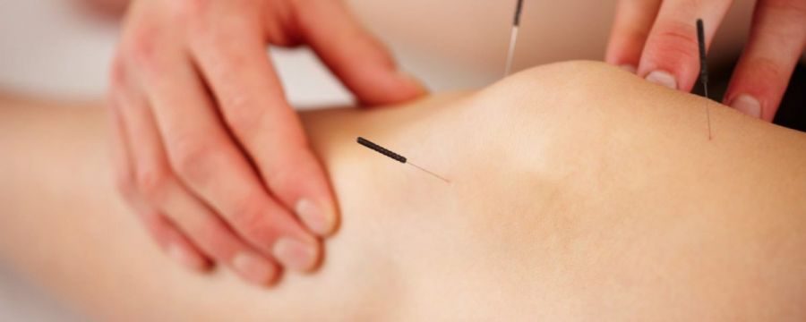 همه چیز در مورد فیزیوتراپی با درای نیدلینگ : درای نیدلینگ (سوزن خشک) چیست؟