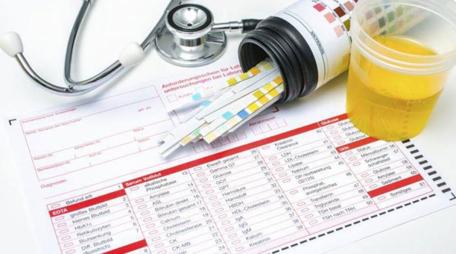 دلایل ایجاد بوی آمونیاک ادرار و روش های خلاص شدن از آن