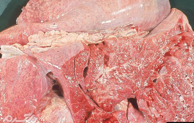تشخیص بیماری تیلریوز در گوشت