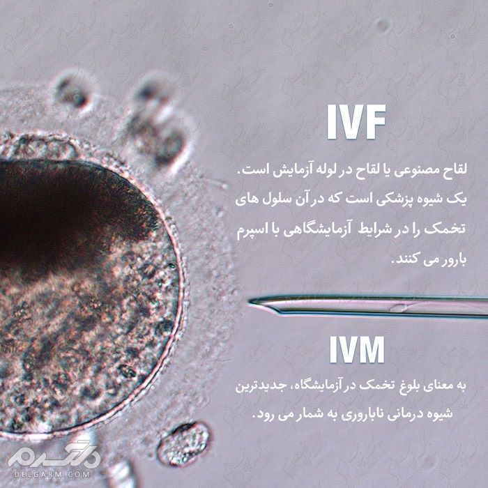 IVM چیست؟