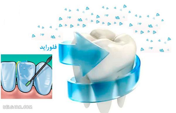 فلوراید