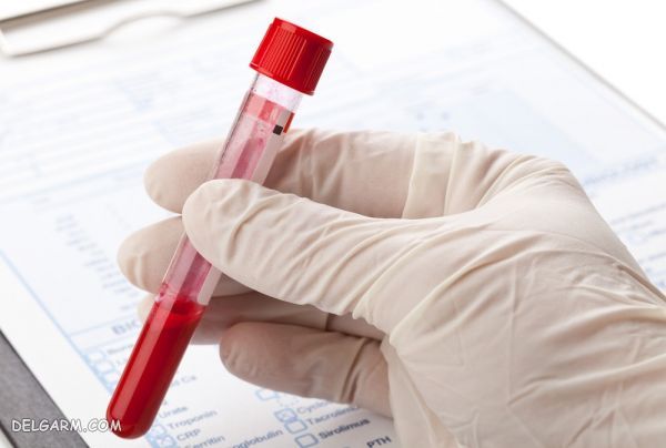 ESR در آزمایش / ESR / محدوده خطر esr / خطر بالا بودن esr / عوارض بالا بودن esr / پایین بودن esr در آزمایش خون نشانه چیست / بالا بودن esr در آزمایش خوندر آزمایش خون