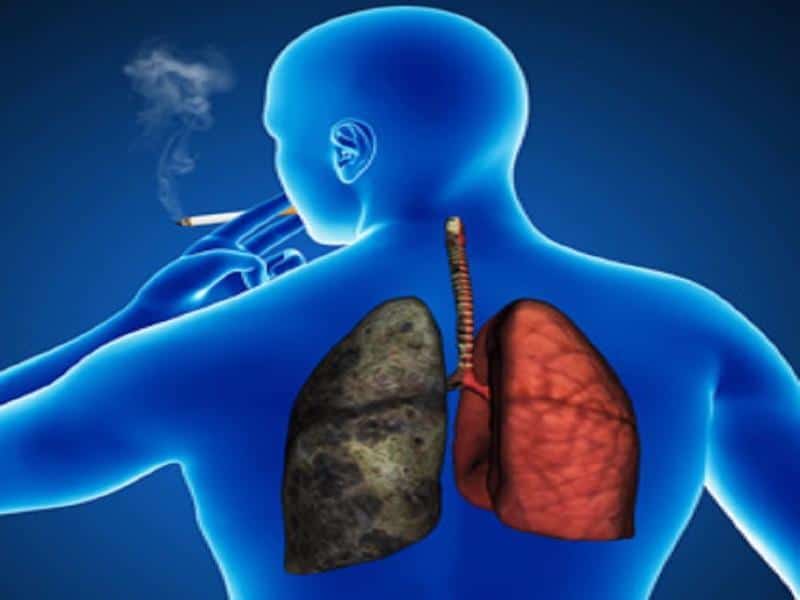 آیا ریه ی افراد سیگاری پس از ترک بهبود می یابد ؟