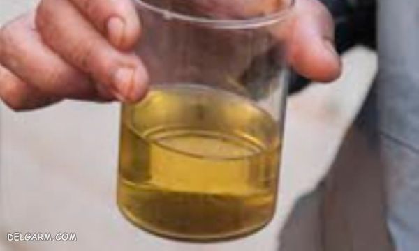 ادرار نارنجی رنگ