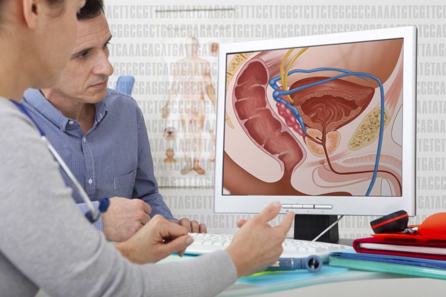 پروستات خوش خیم یعنی چه و چگونه درمان میشود ؟