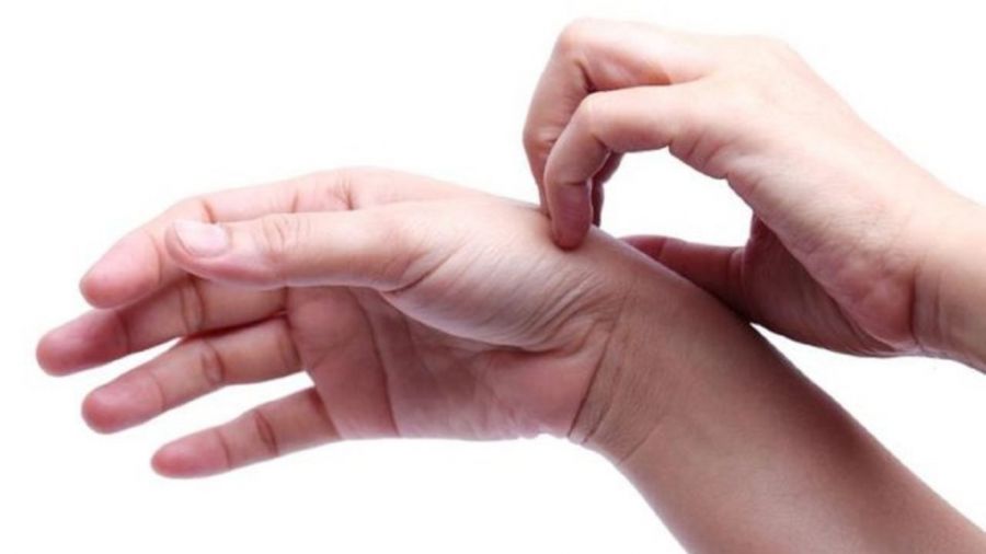 کلستاز کبدی چیست و چگونه درمان میشود ؟