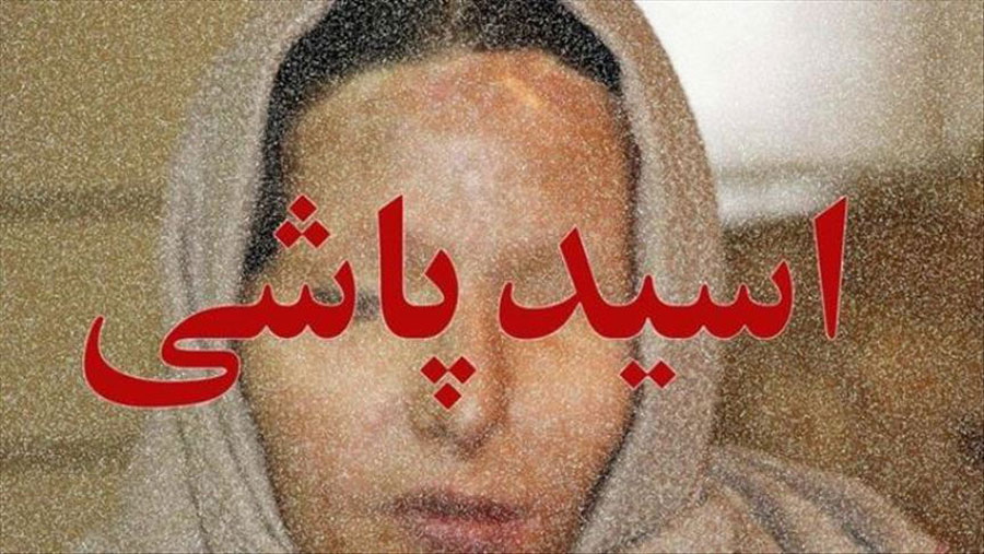 مصوبه مجلس برای اعدام مجرمان اسیدپاشی