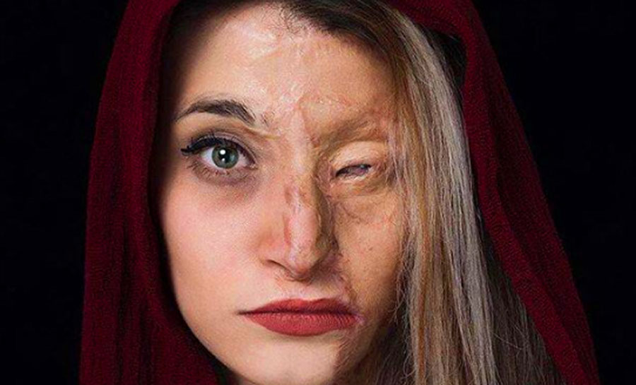 نتیجه پرونده اسیدپاشی اصفهان