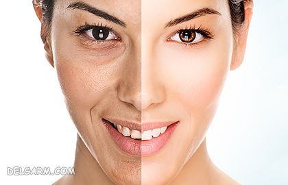 برای برنزه شدن با نور خورشید چه باید کرد؟