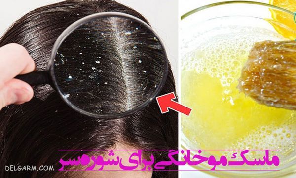 ماسک مو ضد شوره