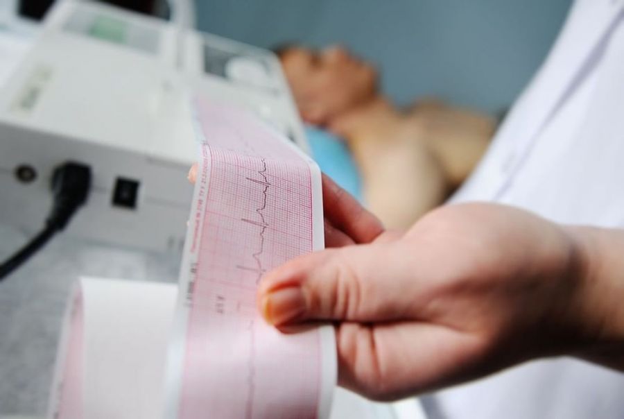 دستگاه نوار قلب (ECG) چیست و چه کاربردی دارد ؟
