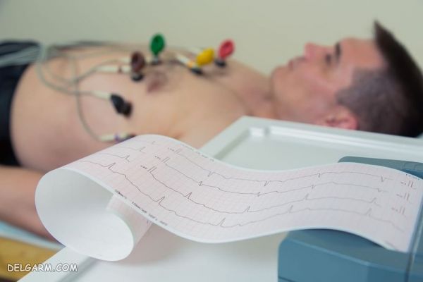 ECG چیست؟ ۱۹ نکته مهم درتشخیص نوار قلب