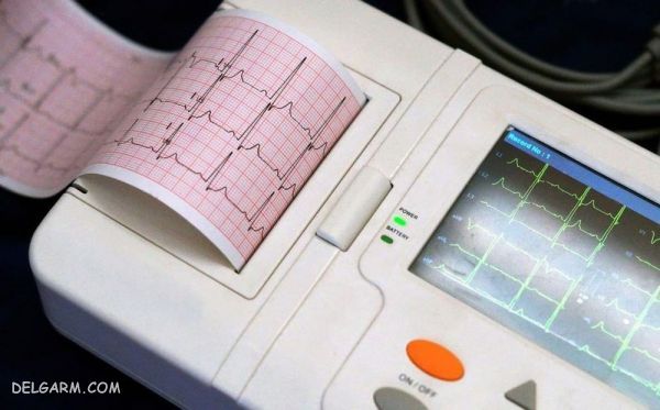 همه چیز در مورد الکتروکاردیوگرام یا ECG یا EKD