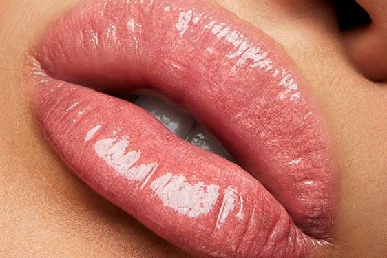 مراحل و مراقبت های تزریق ژل لب مدل چاکدار