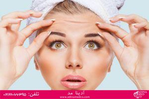 چرا فیلرهای زیبایی تزریق کنیم ؟