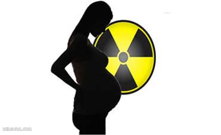 تاثیر اشعه ایکس بر جنین