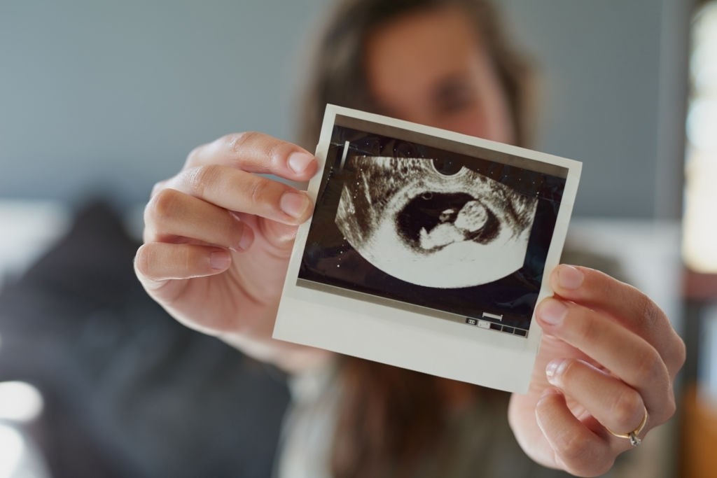  تشخیص جنسیت بچه در زمان بارداری