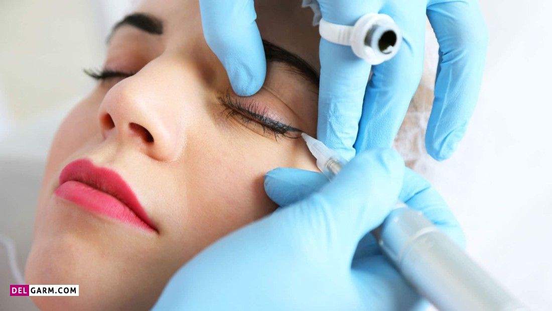 درمان ورم و عوارض بعد از تاتو چشم