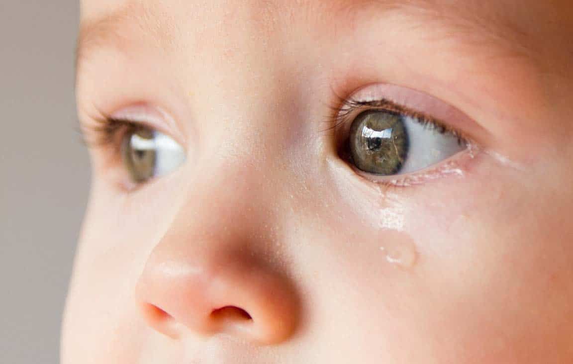درمان چشم های آبکی نوزاد 
