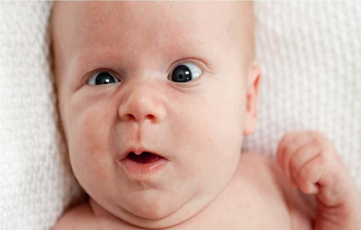  ضعف بینایی در نوزادان