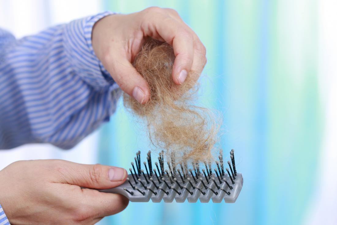 درمان طبیعی ریزش مو
