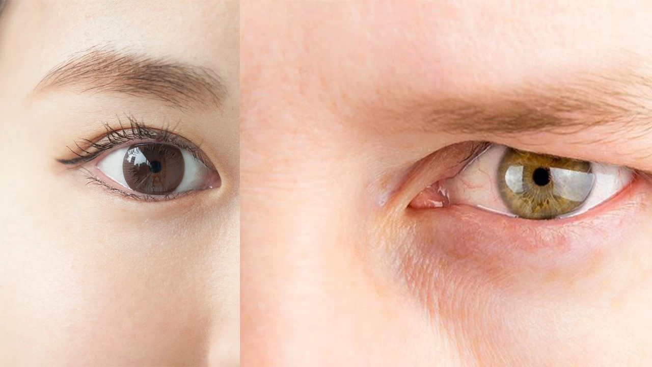 انواع پلک چشم