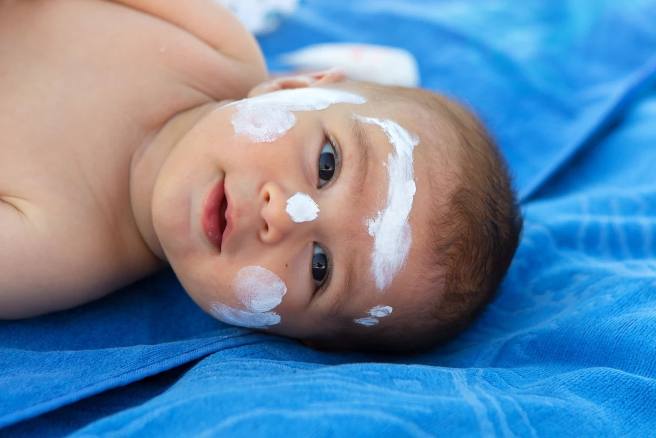 فواید ضد آفتاب کودک