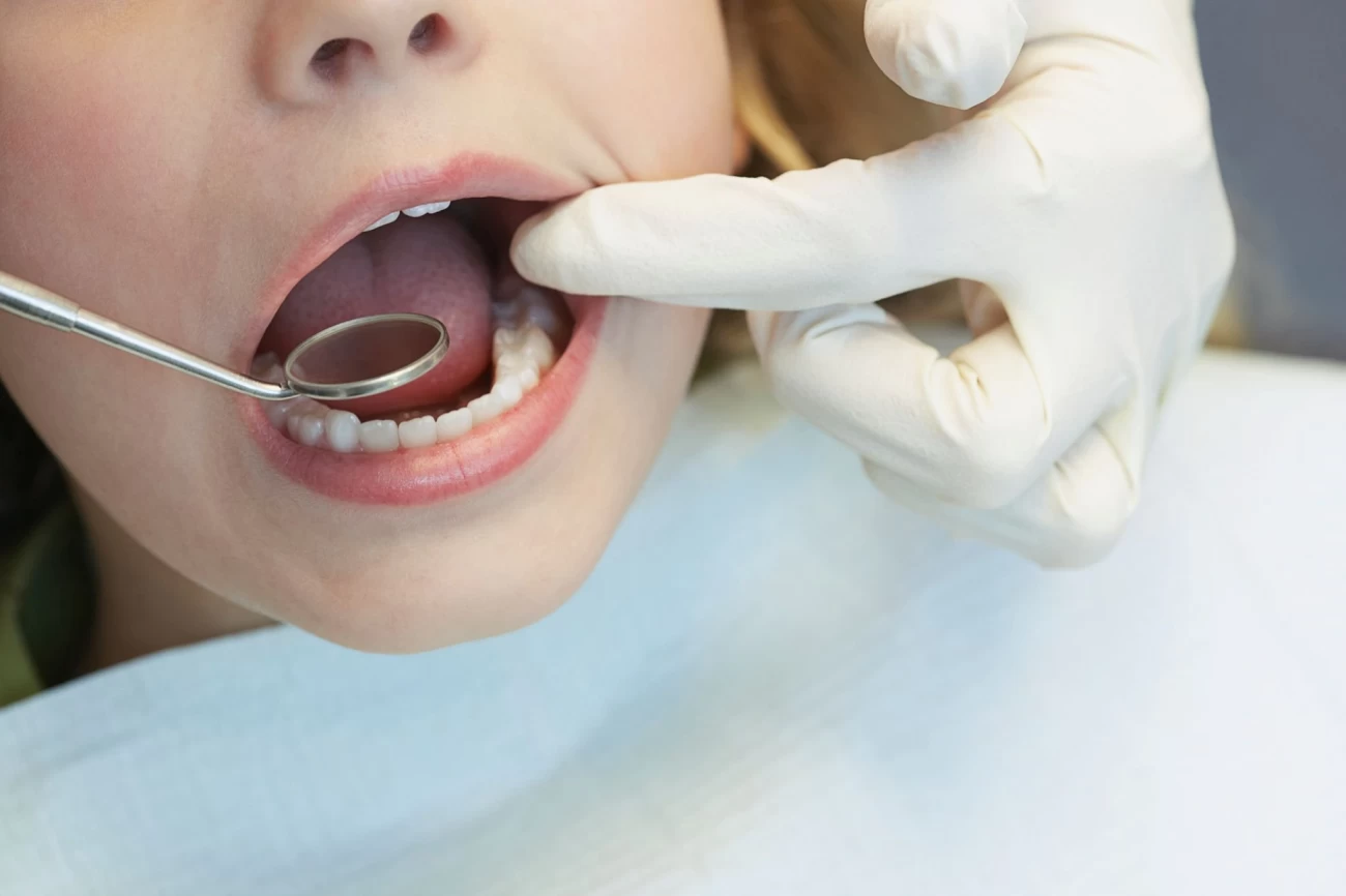 عصب ‌کشی دندان چگونه انجام می‌شود؟