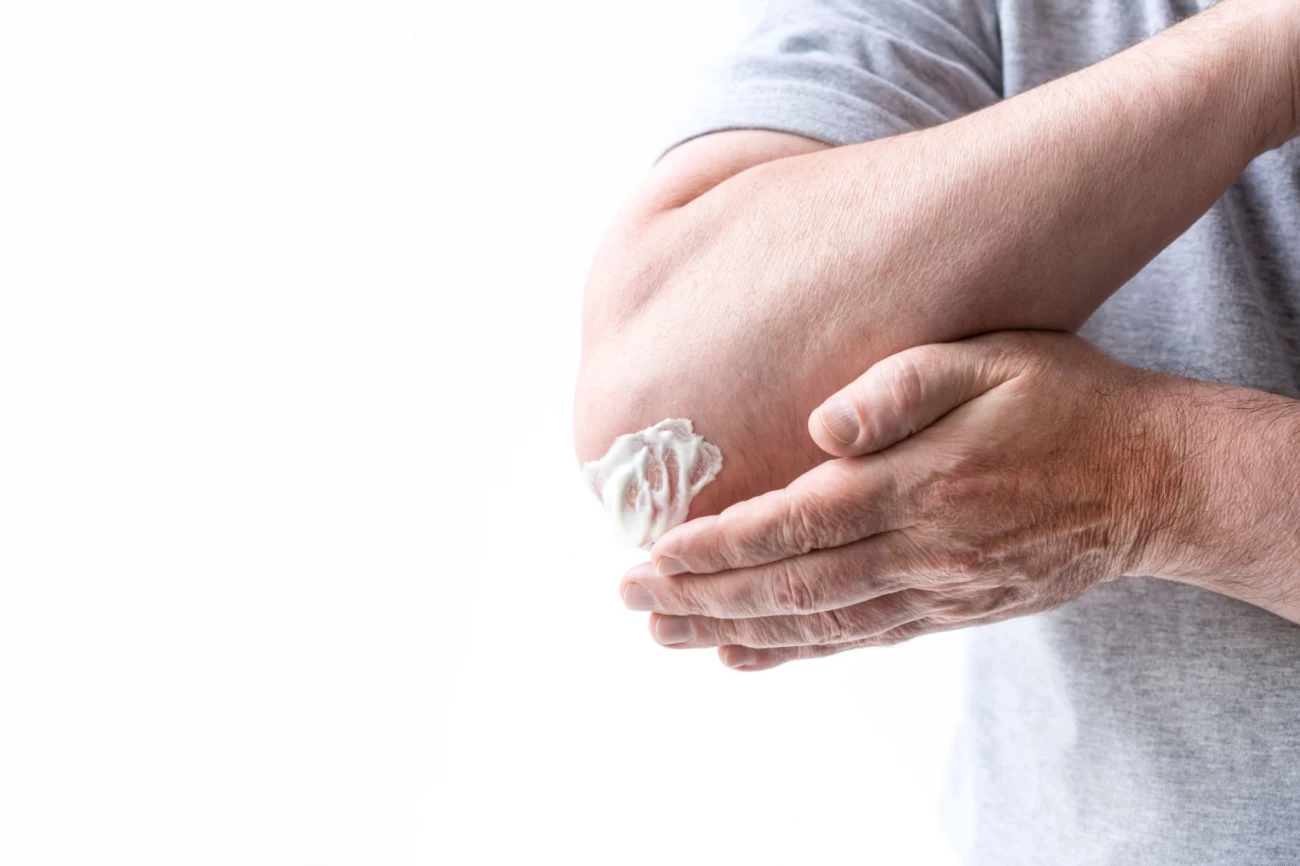 علت ایجاد لکه های قهوه ای روی پوست چیست؟