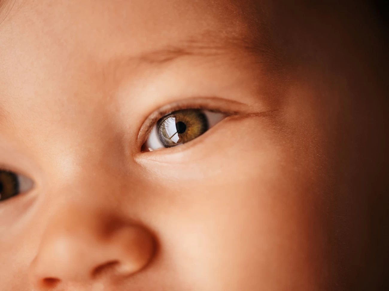 حساسیت چشمی کودکان