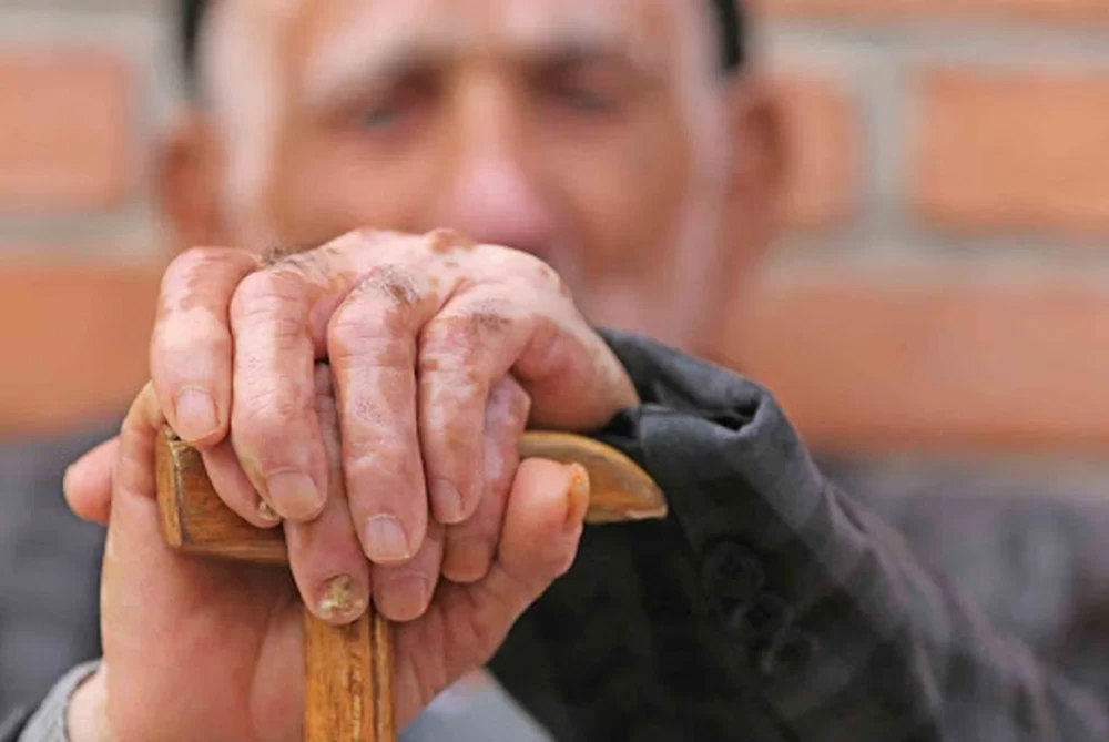 عوارض سالمندی