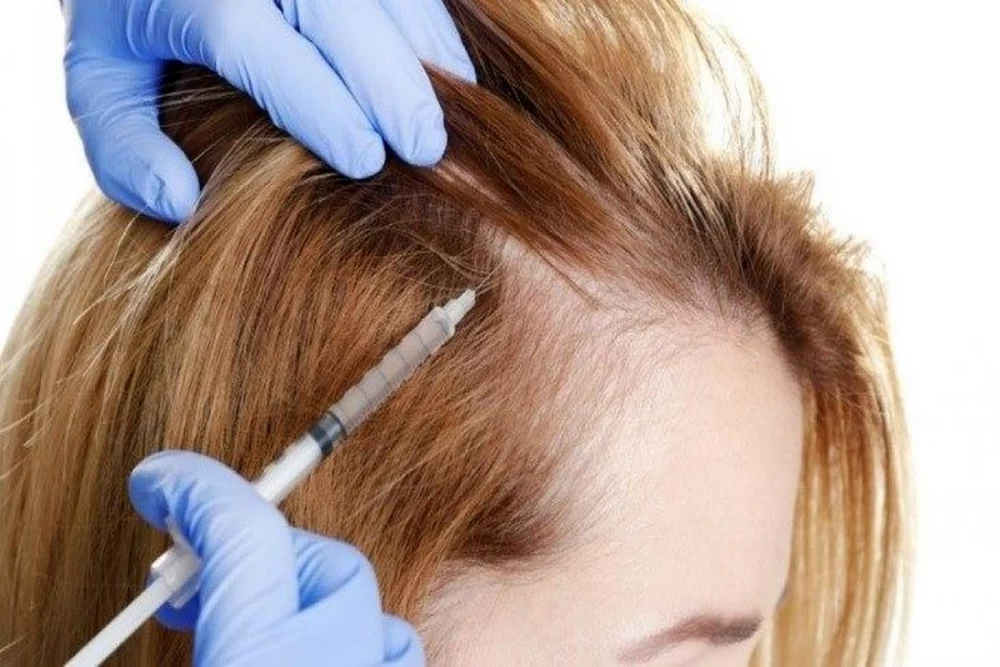 مراقبت های بعد از پی آر پی