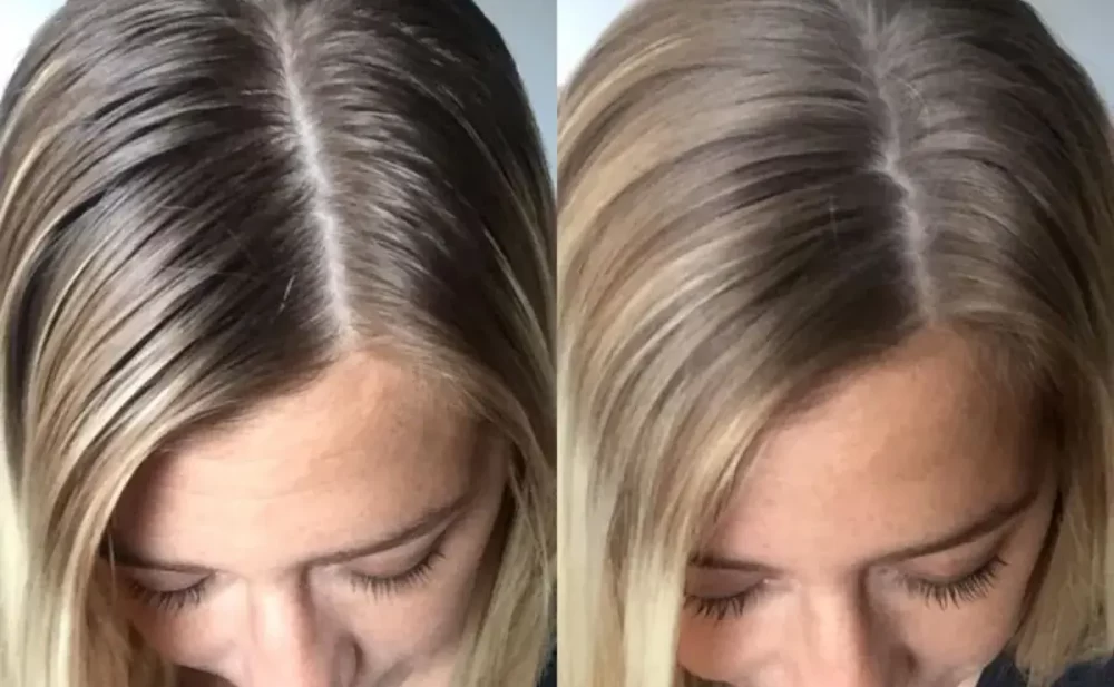 فواید شامپو خشک